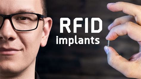 what is a rfid implant